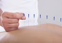 Acupuncture in pain management