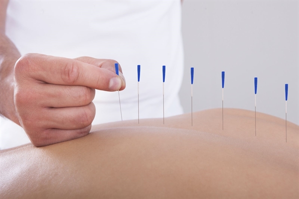 Acupuncture in pain management